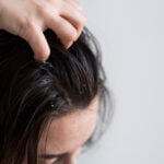 Person scratching their scalp due to dandruff, illustrating discomfort from dandruff and the need for a shampoo that is good for dandruff